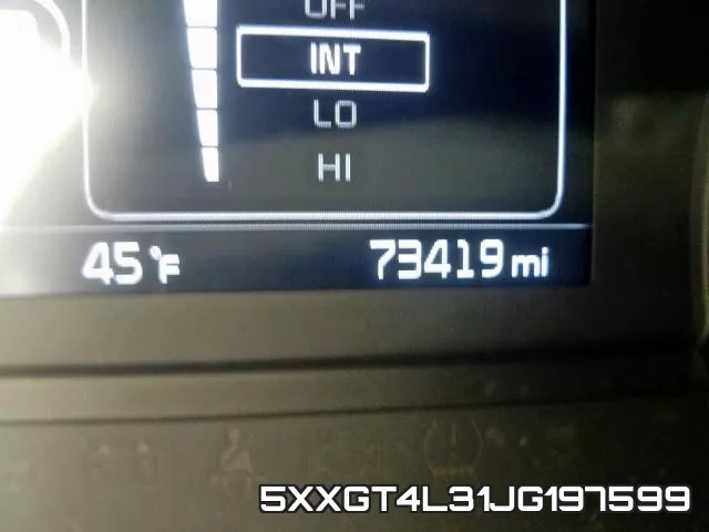 5XXGT4L31JG197599 фото 9