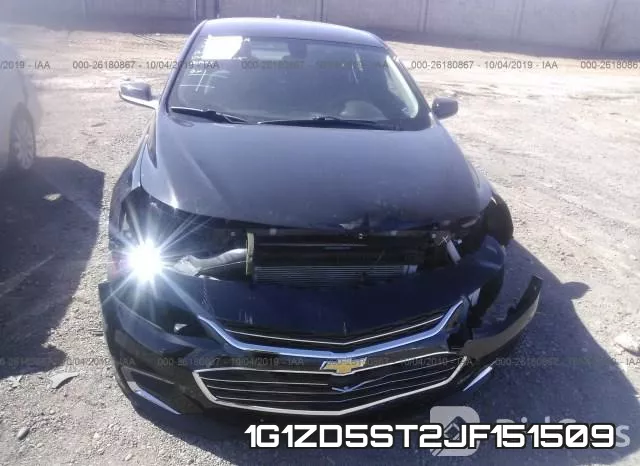 1G1ZD5ST2JF151509 фото 6