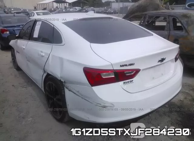 1G1ZD5STXJF284230 фото 4