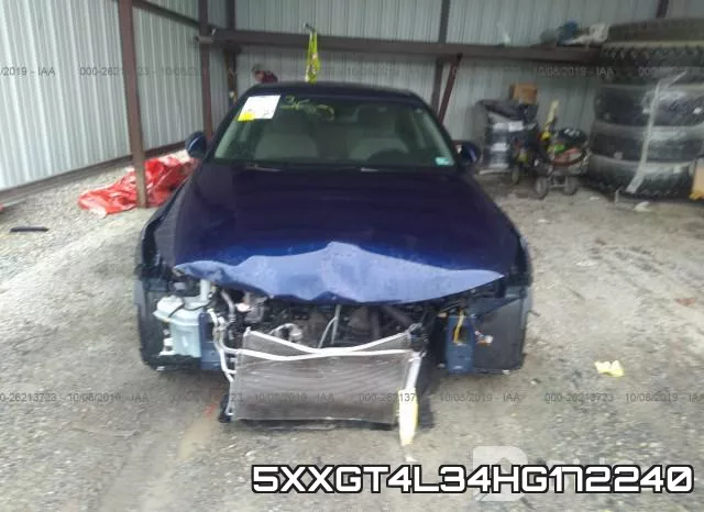 5XXGT4L34HG172240 фото 7