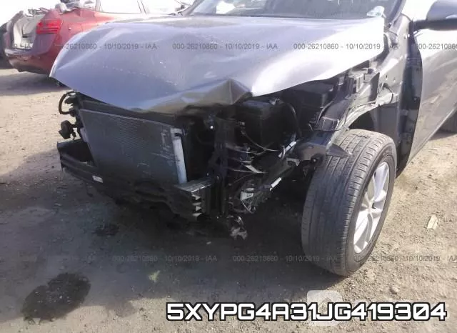 5XYPG4A31JG419304 фото 7