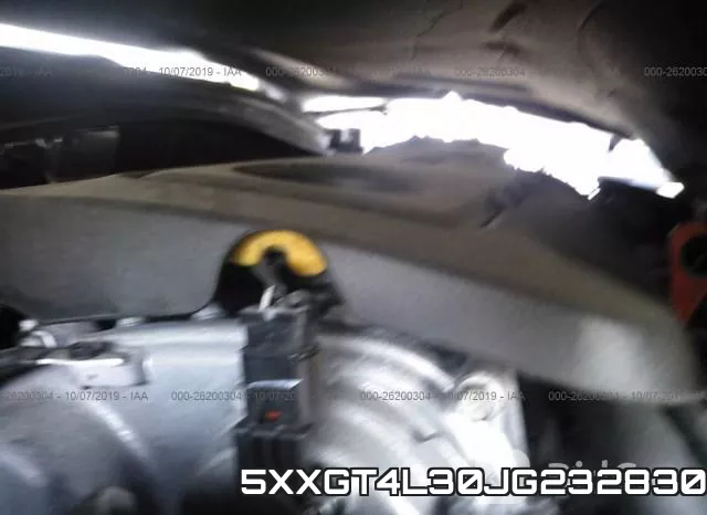 5XXGT4L30JG232830 фото 2