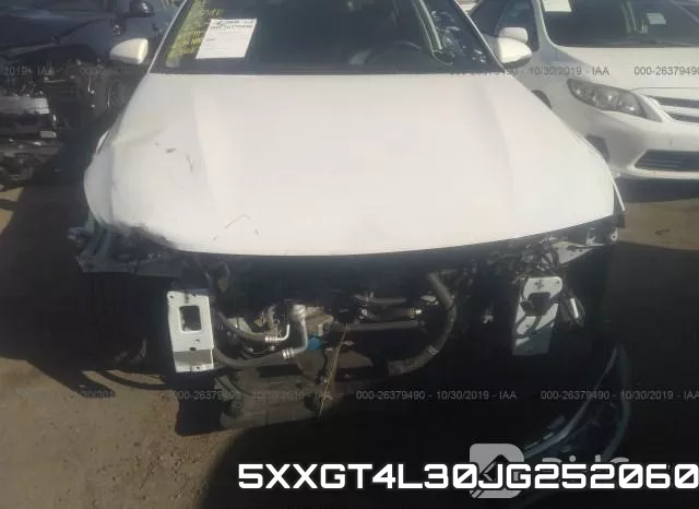 5XXGT4L30JG252060 фото 7