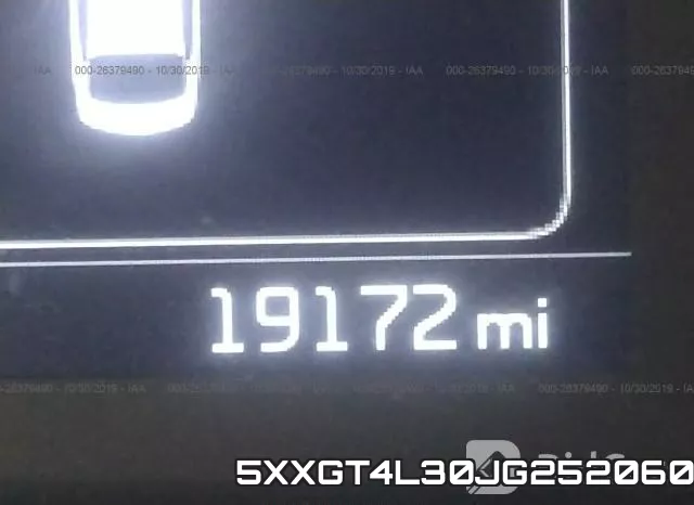5XXGT4L30JG252060 фото 8