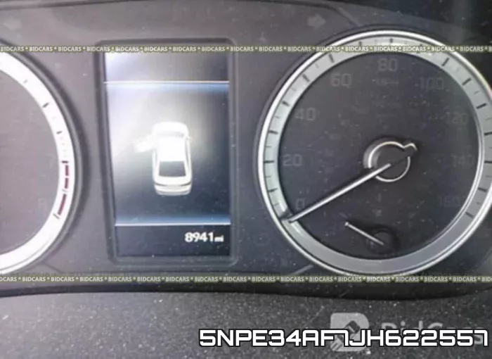 5NPE34AF7JH622557 фото 8