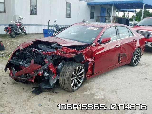 1G6A15S65J0174876 фото 3