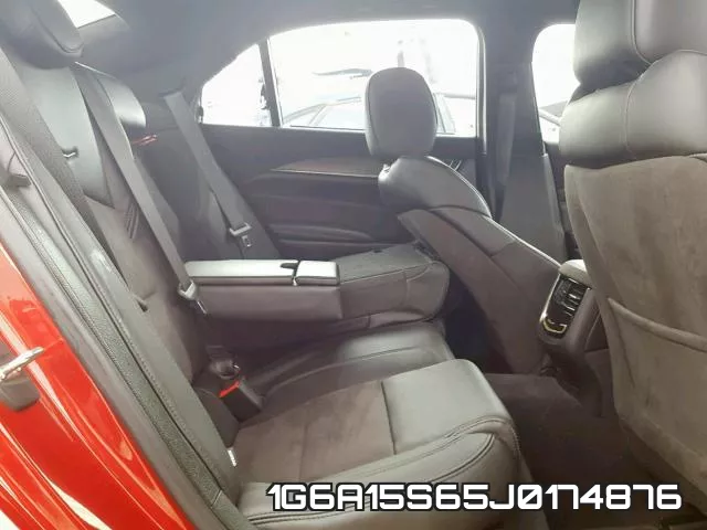 1G6A15S65J0174876 фото 7