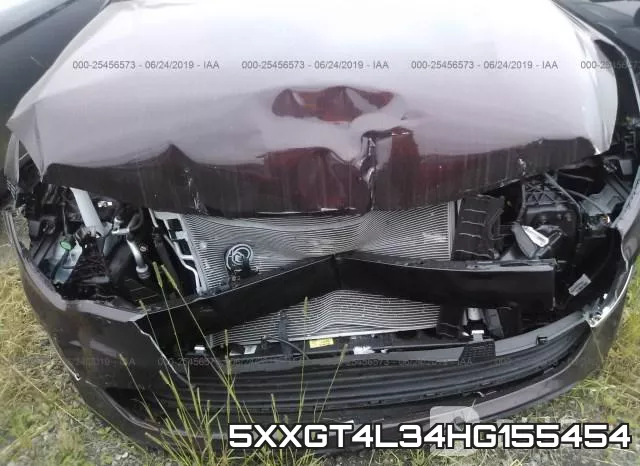 5XXGT4L34HG155454 фото 7