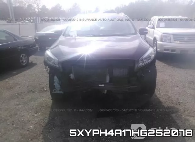 5XYPH4A17HG252078 фото 7