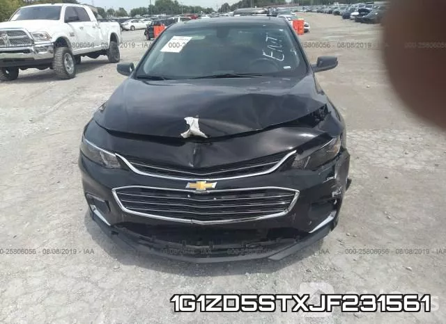 1G1ZD5STXJF231561 фото 7