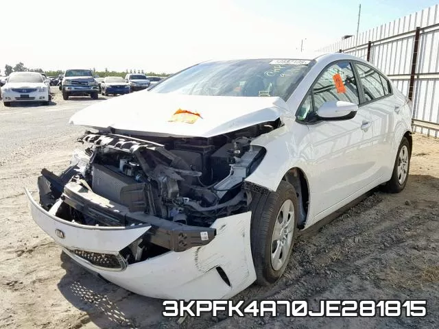 3KPFK4A70JE281815 фото 3