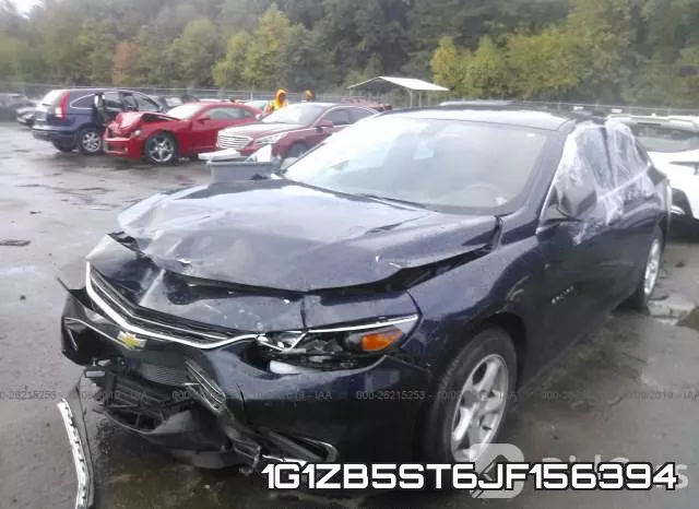 1G1ZB5ST6JF156394 фото 3