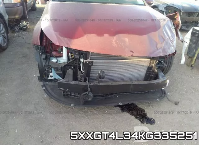 5XXGT4L34KG335251 фото 7