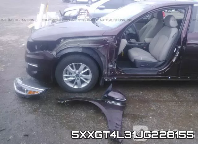 5XXGT4L31JG228155 фото 7