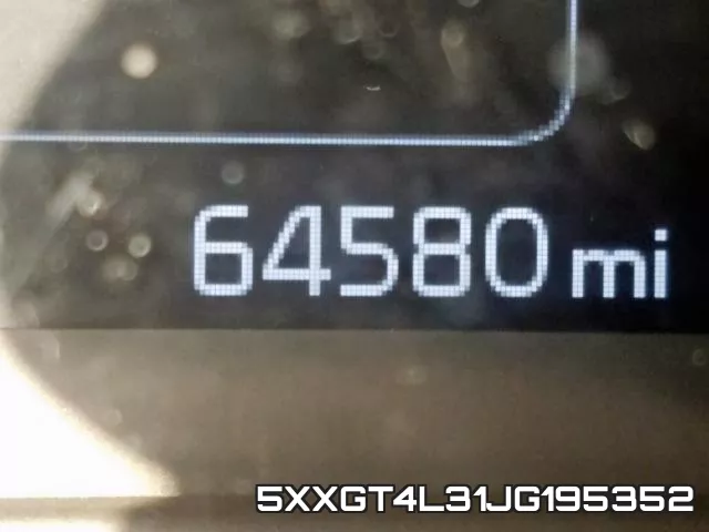 5XXGT4L31JG195352 фото 9