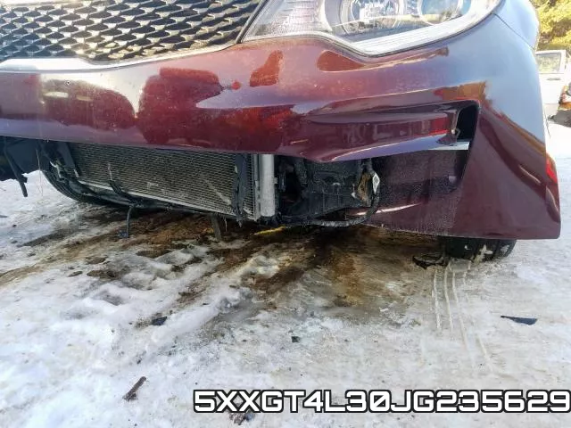 5XXGT4L30JG235629 фото 6
