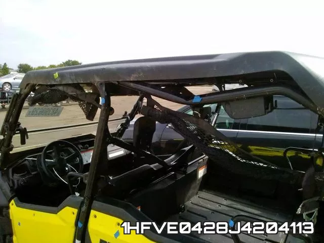 1HFVE0428J4204113 фото 10