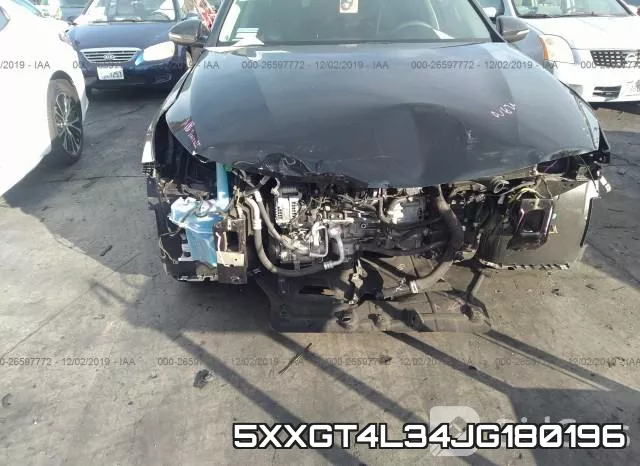 5XXGT4L34JG180196 фото 7