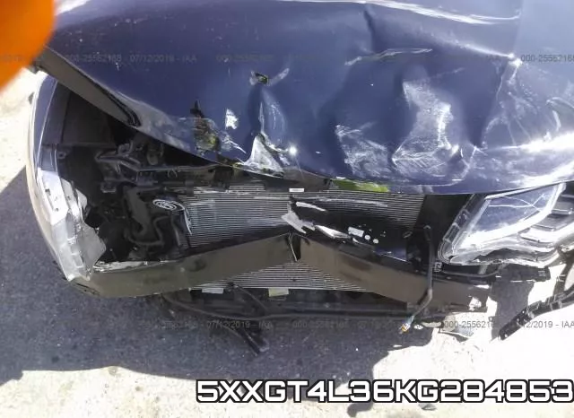 5XXGT4L36KG284853 фото 7