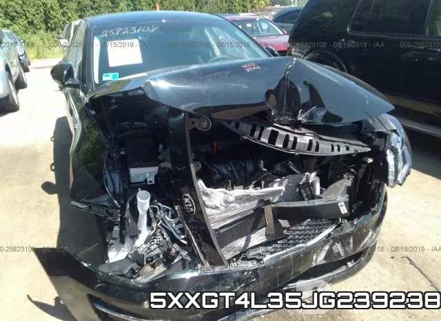 5XXGT4L35JG239238 фото 6