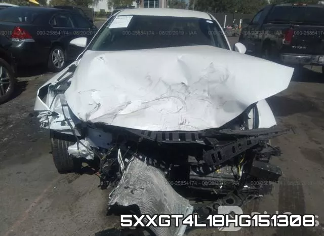 5XXGT4L18HG151308 фото 6