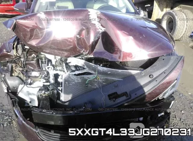 5XXGT4L33JG270231 фото 3