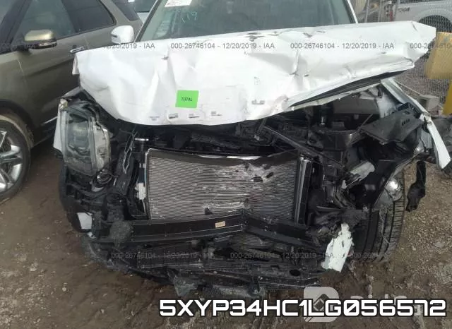 5XYP34HC1LG056572 фото 6