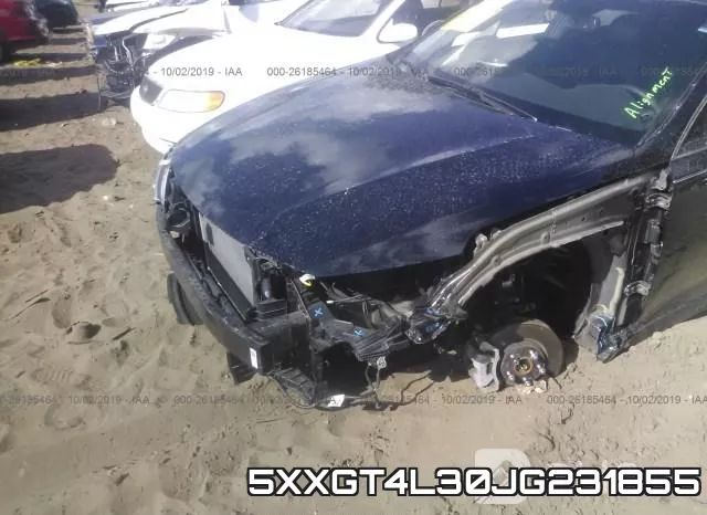 5XXGT4L30JG231855 фото 7