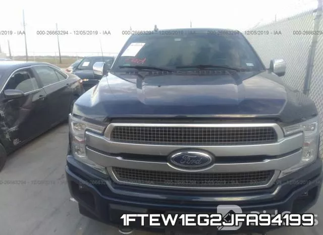1FTEW1EG2JFA94199 фото 7