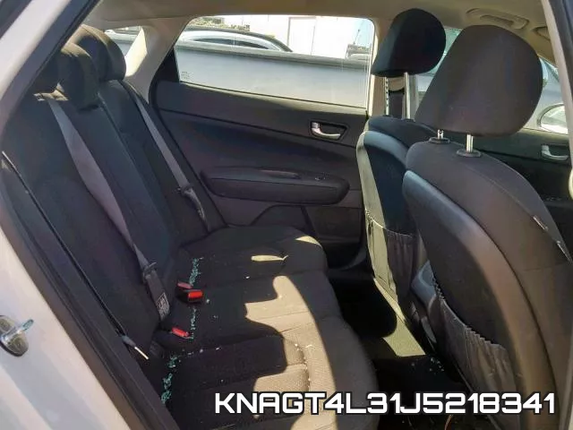 KNAGT4L31J5218341 фото 6