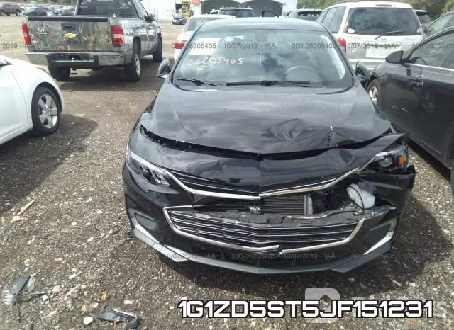 1G1ZD5ST5JF151231 фото 7