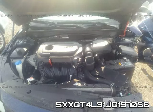 5XXGT4L31JG197036 фото 2