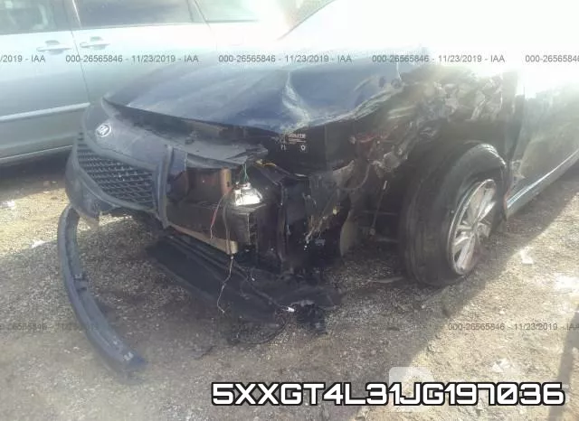 5XXGT4L31JG197036 фото 5