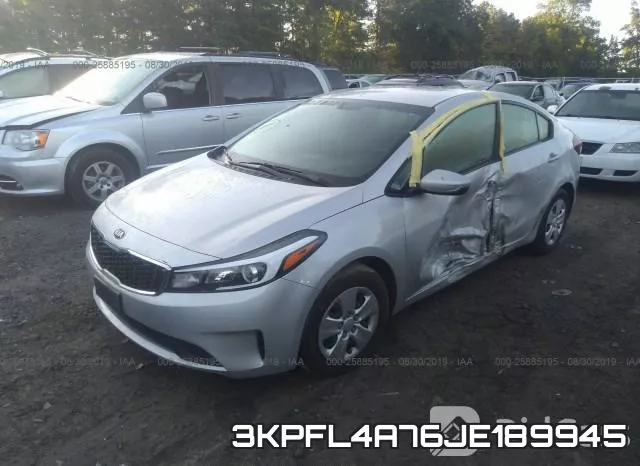 3KPFL4A76JE189945 фото 3