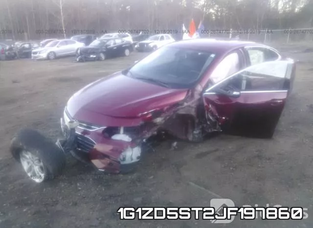 1G1ZD5ST2JF197860 фото 2