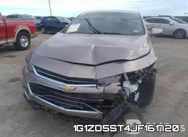 1G1ZD5ST4JF161720 фото 7