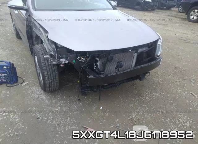 5XXGT4L18JG178952 фото 5
