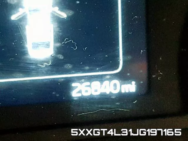5XXGT4L31JG197165 фото 7