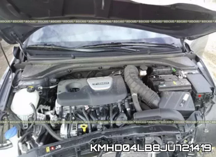 KMHD04LB8JU721419 фото 2