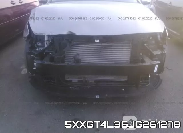 5XXGT4L36JG261278 фото 4