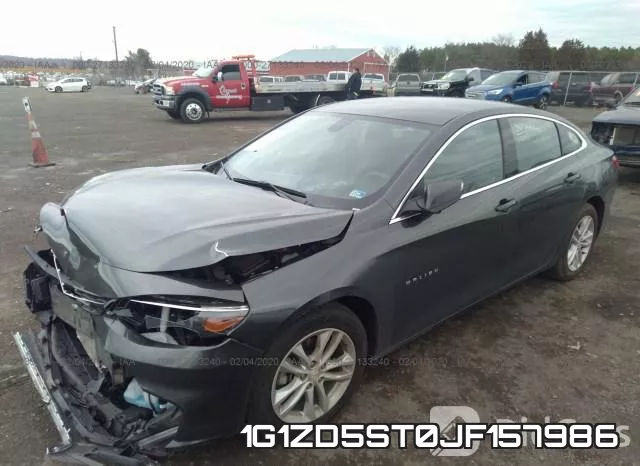 1G1ZD5ST0JF157986 фото 2