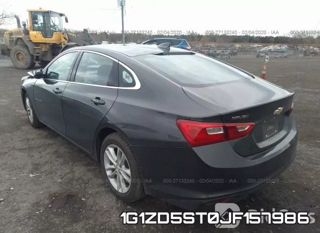 1G1ZD5ST0JF157986 фото 3