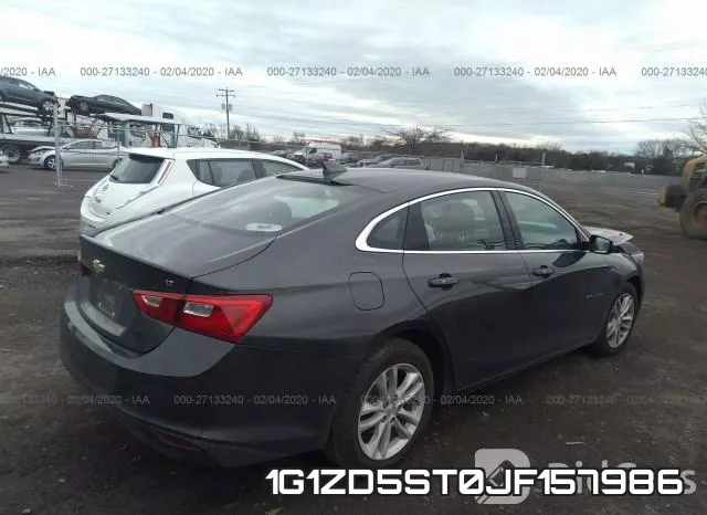 1G1ZD5ST0JF157986 фото 4
