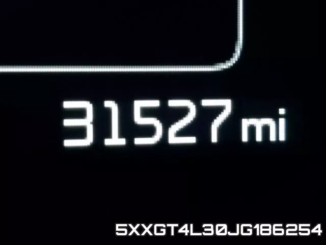 5XXGT4L30JG186254 фото 7