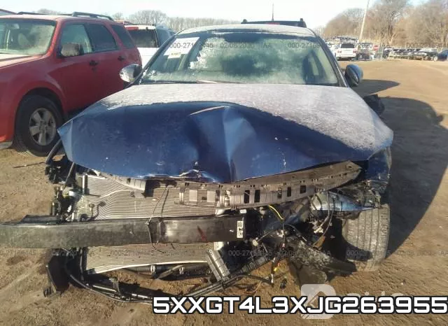 5XXGT4L3XJG263955 фото 6
