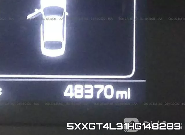 5XXGT4L31HG148283 фото 8