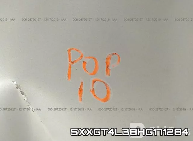 5XXGT4L38HG171284 фото 2