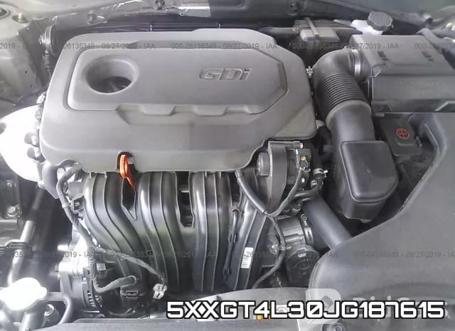 5XXGT4L30JG187615 фото 2