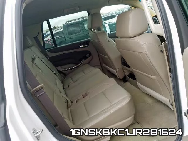 1GNSKBKC1JR281624 фото 7
