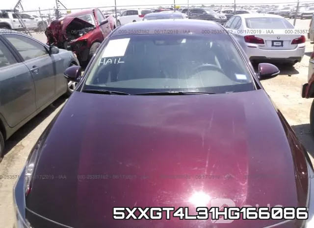 5XXGT4L31HG166086 фото 4